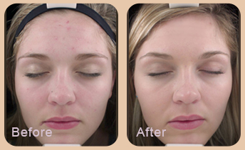 Dermatologist Baton Rouge - Gallery Image 01