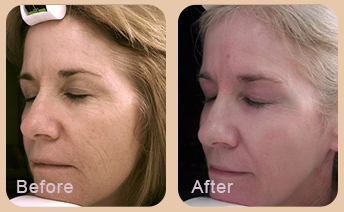 Dermatologist Baton Rouge - Gallery Image 03