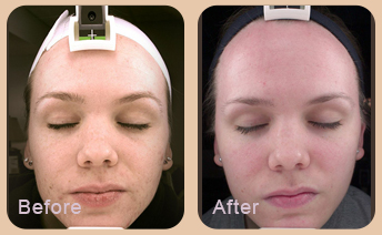 Dermatologist Baton Rouge - Gallery Image 05