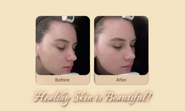 Dermatologist Baton Rouge - Slider Image 07