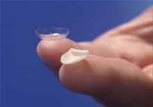 Porcelain Veneers West Chester - Porcelain Veneers image 01