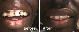 Before and After8