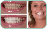 Dentist Laguna Hills - Gallery Thumb 01