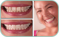 Dentist Laguna Hills - Gallery Thumb 02