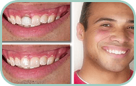 Dentist Laguna Hills - Gallery Thumb 03