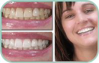 Dentist Laguna Hills - Gallery Thumb 04