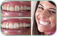 Dentist Laguna Hills - Gallery Thumb 05