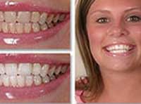 Smile Gallery Laguna Hills - Smile gallery image 1