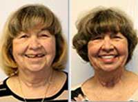 Smile Gallery Laguna Hills - Smile gallery image 10