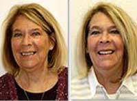 Smile Gallery Laguna Hills - Smile gallery image 12