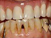 Smile Gallery Laguna Hills - Smile gallery image 15