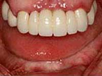 Smile Gallery Laguna Hills - Smile gallery image 16