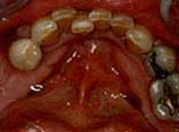 Smile Gallery Laguna Hills - Smile gallery image 17