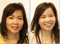 Smile Gallery Laguna Hills - Smile gallery image 18