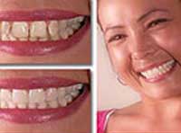 Smile Gallery Laguna Hills - Smile gallery image 2