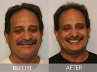 Smile Gallery Laguna Hills - Smile gallery image 21