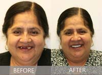 Smile Gallery Laguna Hills - Smile gallery image 22