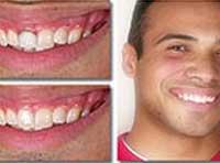 Smile Gallery Laguna Hills - Smile gallery image 3