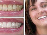 Smile Gallery Laguna Hills - Smile gallery image 4
