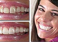 Smile Gallery Laguna Hills - Smile gallery image 5