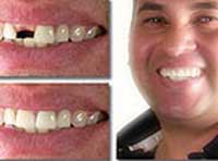 Smile Gallery Laguna Hills - Smile gallery image 6
