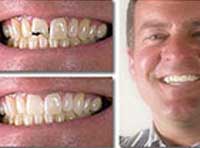 Smile Gallery Laguna Hills - Smile gallery image 7