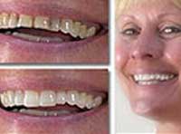 Smile Gallery Laguna Hills - Smile gallery image 8