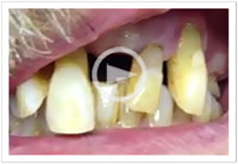 Video Gallery Laguna Hills - Video 5