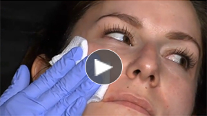 AQUAGOLD® fine touch™ Video