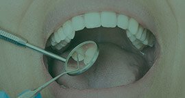 Schedule a Consult