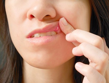 Oral Cancer Screening Bloomington