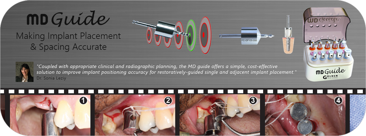 Physics Forceps - Golden Dental Solutions - Banner 1