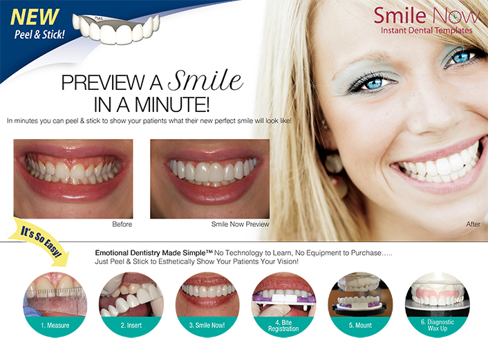 Instant Dental Templates - Smile Now Image