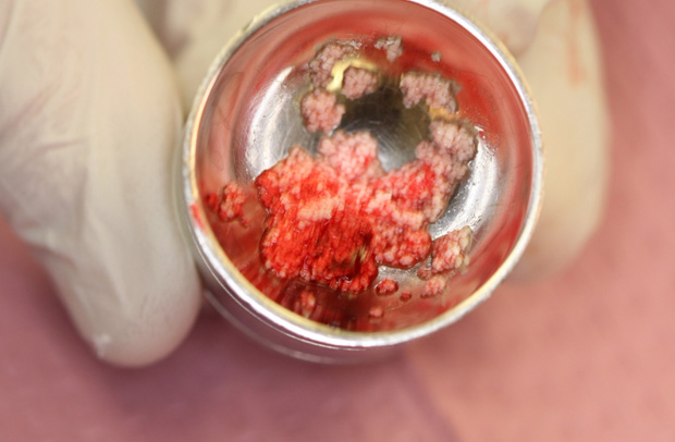 Dental Clinical Videos - Step 3 - 3 Image