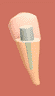 Crown Remover - Drilling of the crown's Cervical area