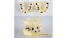 Typodont Tooth Model 
