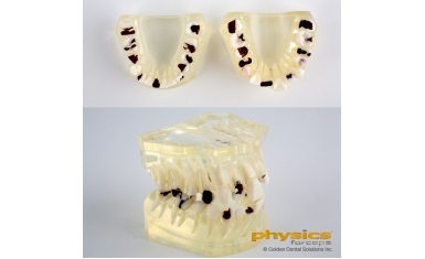 Typodont Tooth Model 