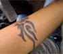 Dermatologist Birmingham - Video Thumbnail 01