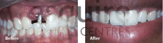 Before After Case 02