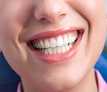 How dental bridges in our Pickering practice differ from crown treatment