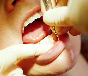 Endodontic surgery, or root canal treatment, available to Scarborough ON area patients from Esquire Dental Centres.