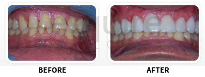 Cosmetic Makeover Image 01