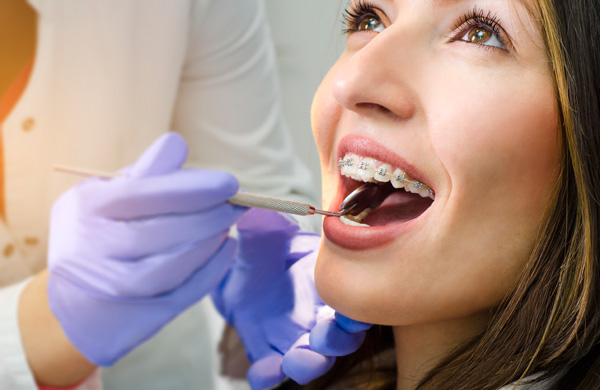 Closeup of beautiful girl with dental braces check up