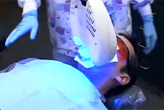 Dentist Chicago Video Gallery - How Power Whitening works Video