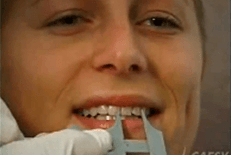 Dentist Chicago Video Gallery - What is Cosmetic Dentistry Video