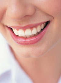 Dental Braces Chicago - Smily Mouth