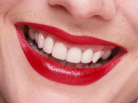 Orthodontist in Chicago - Woman Smile