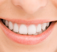 Safe Braces Chicago IL - Mouth with smile