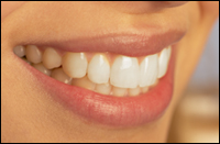 Root Canal Chicago - Simona Laughing