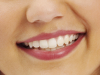 Dental Tooth Bleaching Chicago - Woman with Smile